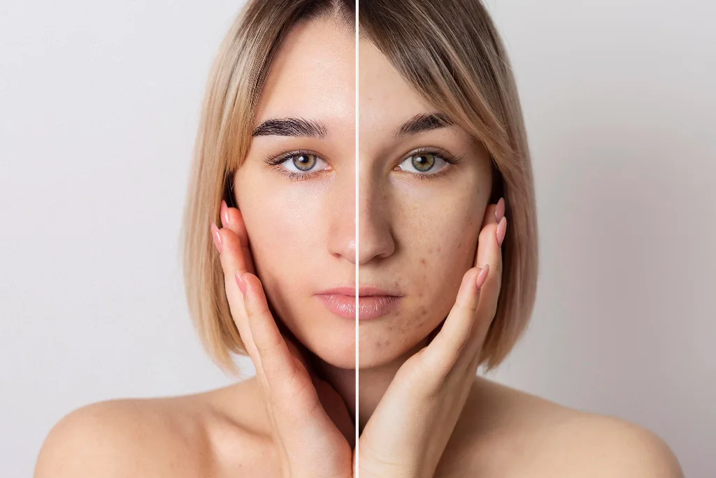 BB Glow Treatment in Islamabad