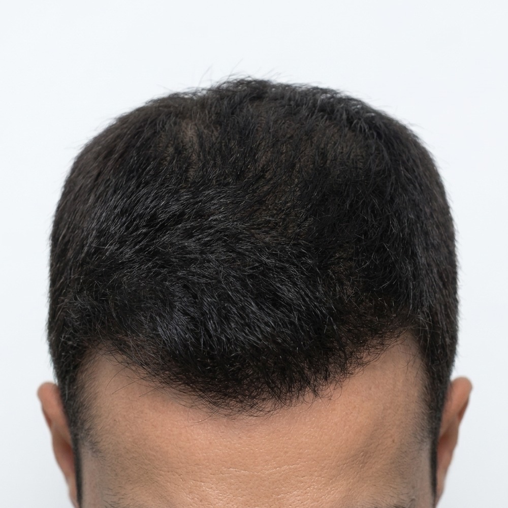 hair_after