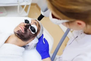 Carbon Laser Peel in Pakistan, The Treatment for Acne, Open Pores and Dull Skin That Actually Works