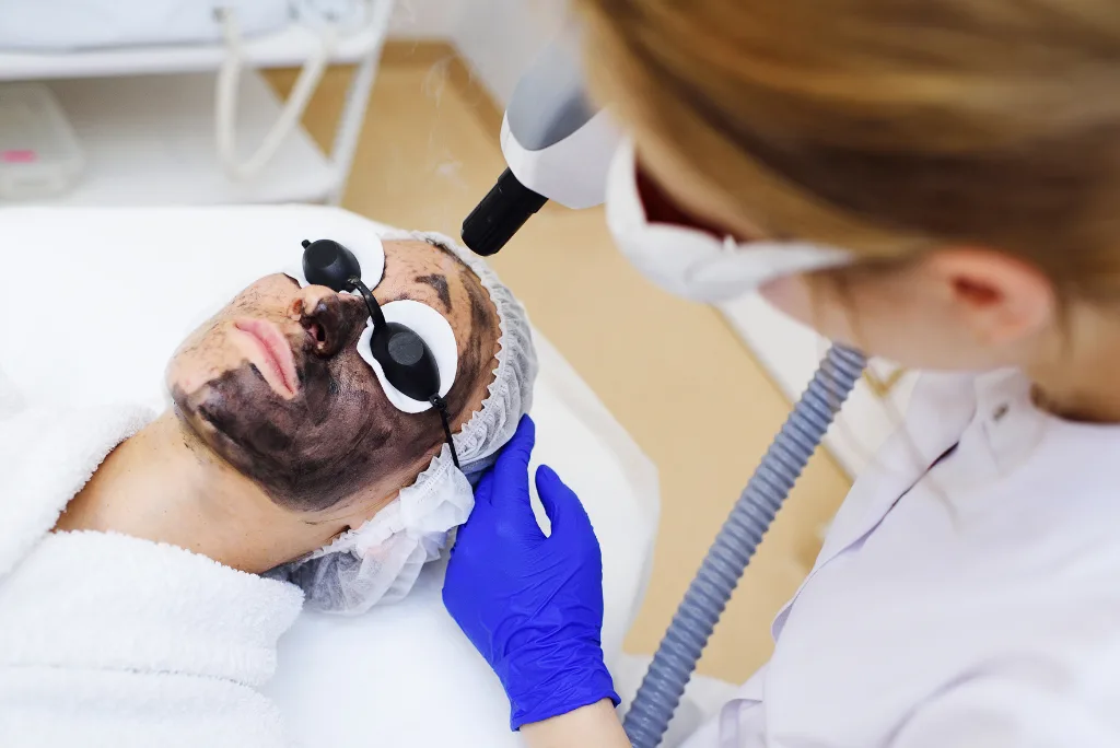 Carbon Laser Peel in Pakistan, What It Is, Who It Is For, and What It Actually Costs