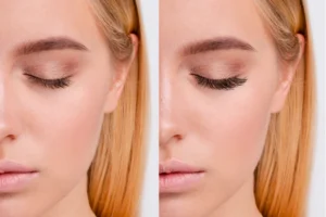 Eyelash extensions applied at Le Lotus Clinique Islamabad