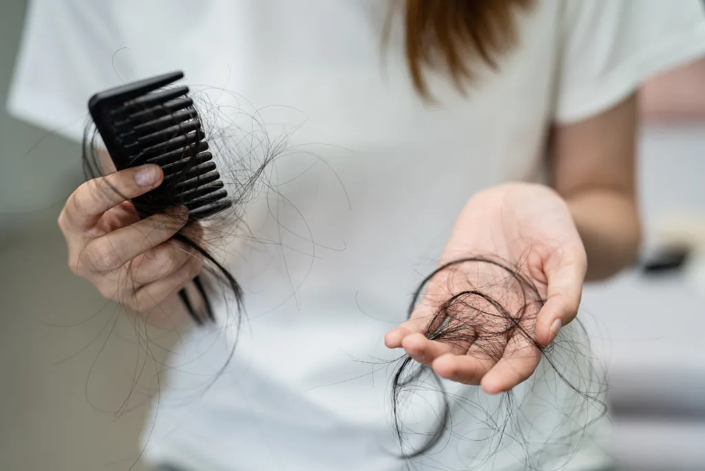 Hair fall issues due to Vitamins Deficiency
