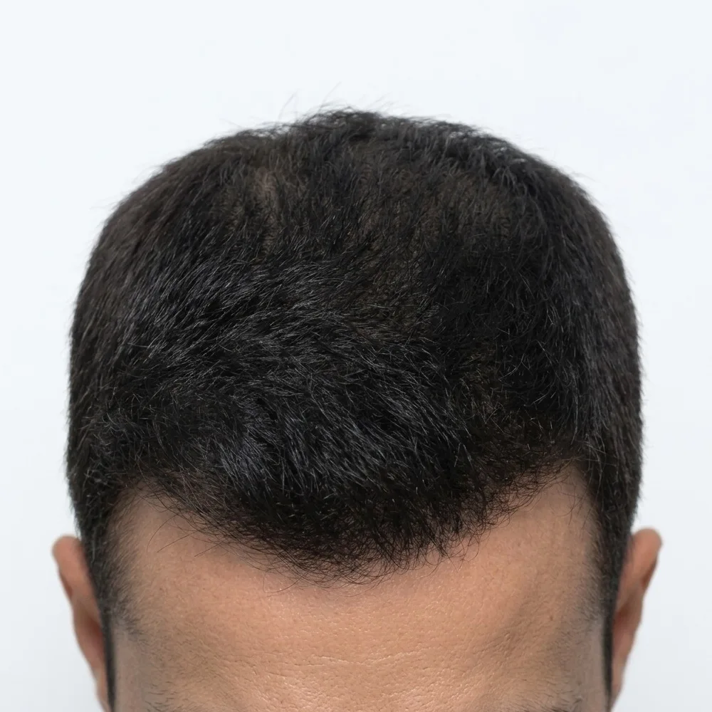 hair after