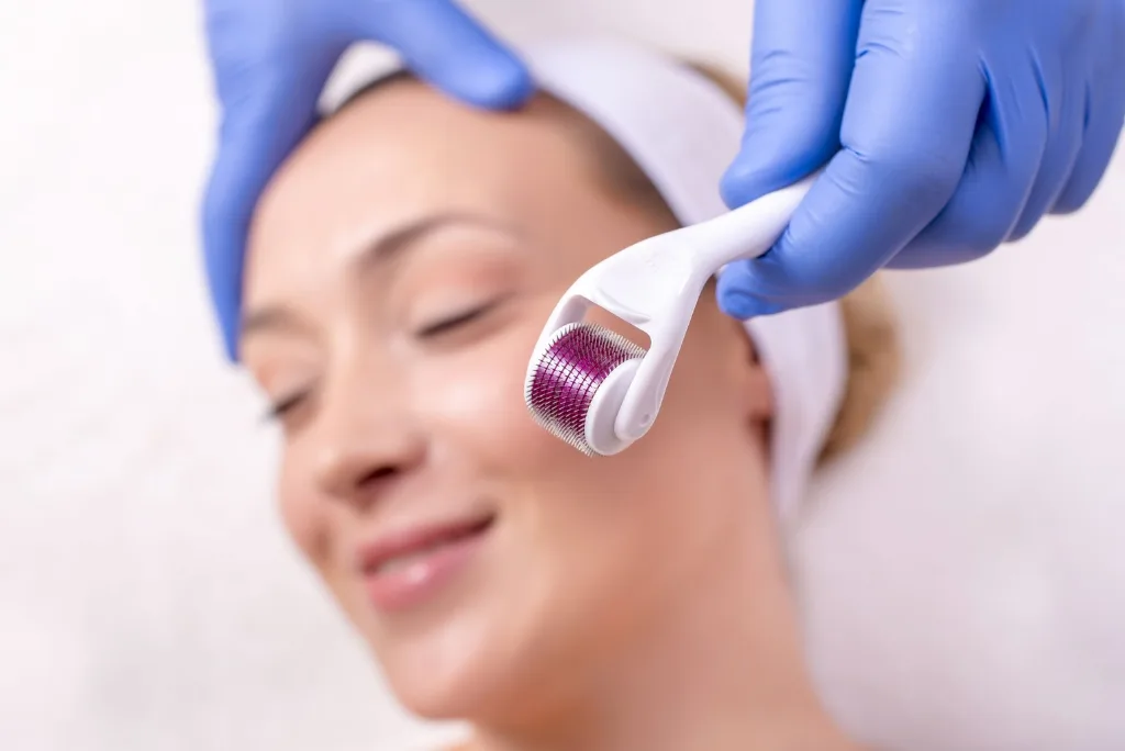 Derma Roller Fix Acne Scars or Help Hair Loss