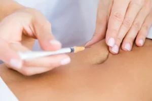 Fat Freezing, HIFU, or Injections in Pakistan