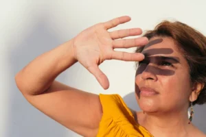 Sun Damage on Brown Skin