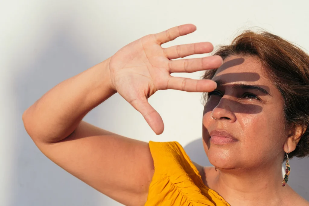 Sun Damage on Brown Skin